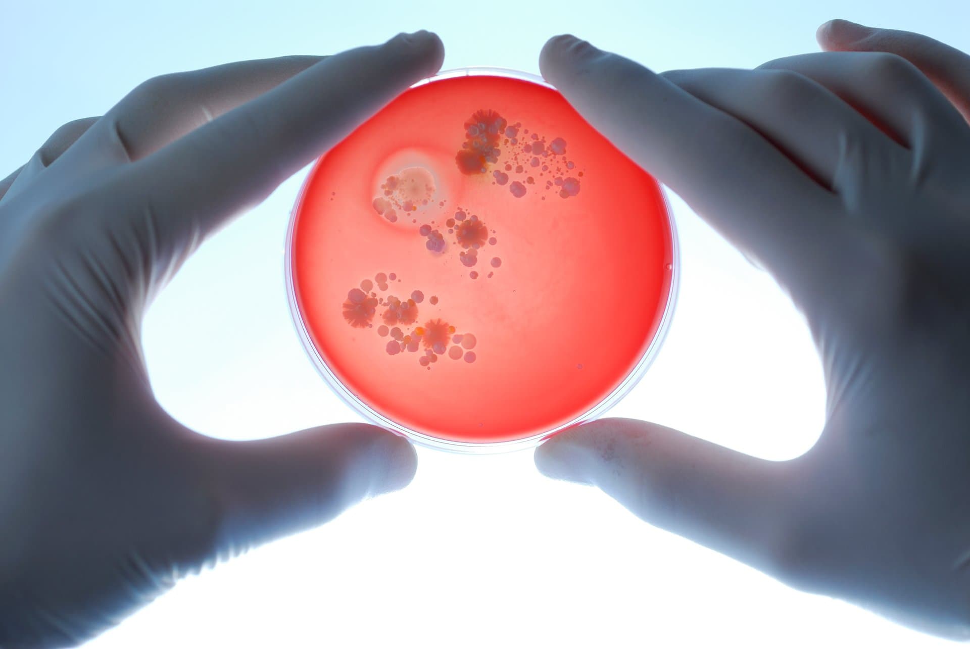 Lab technician wearing white gloves holds a petri dish containing red agar with bacterial colonies, viewed from below against bright light.